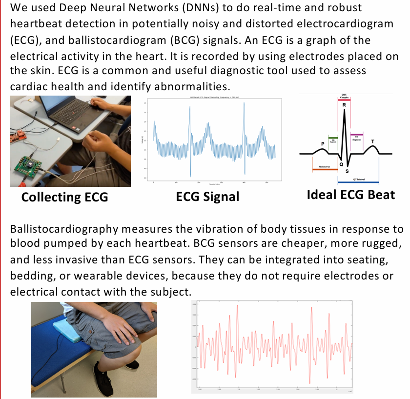 ECG and BCG heartbeat detection research